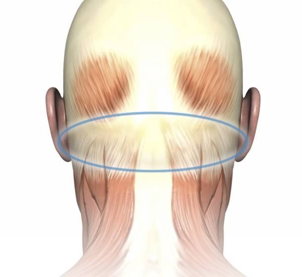  Back Of Neck Pain At The Base Of Skull | 8 Vital Points Of Note