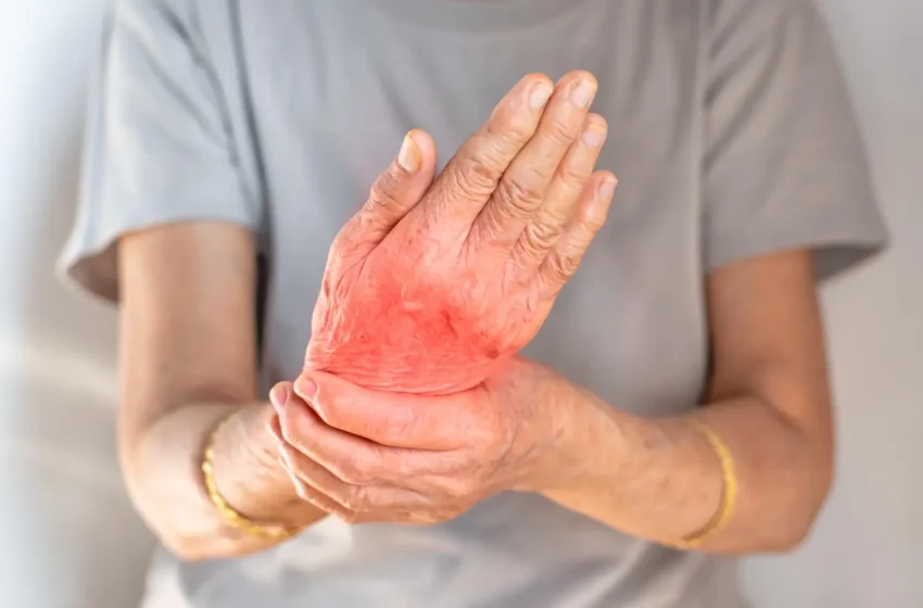Arthritis Pain Relief