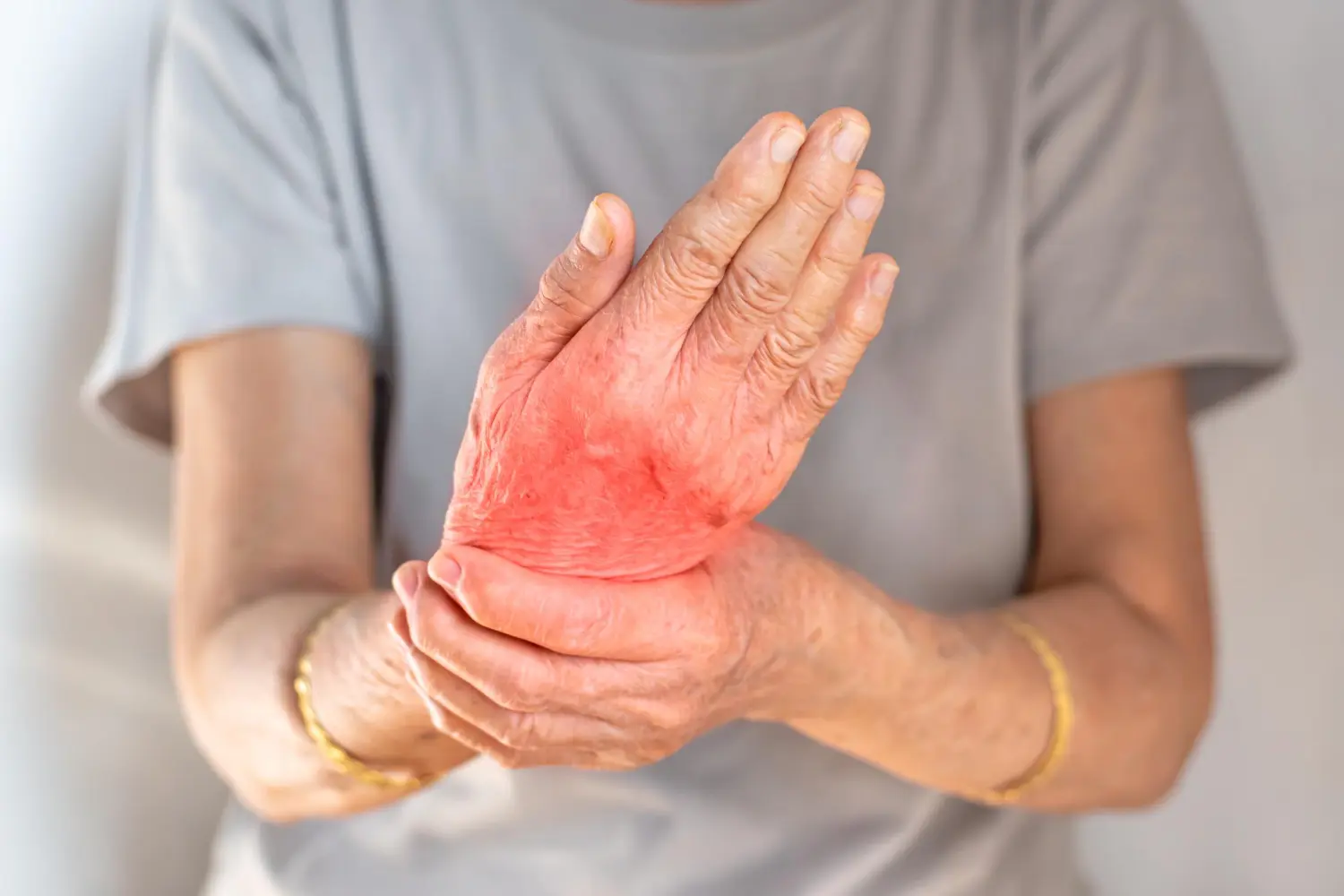 Arthritis Pain Relief